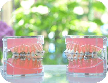 矯正歯科治療における豊富な治療実績・経験がある