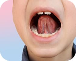 舌で上の前歯を押す癖がある